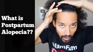 PostPartum Alopecia : What is it?
