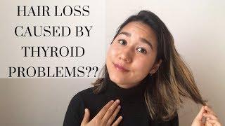 Is your hair loss caused by hypothyroidism? (Hypothyroid Hair Loss Series Part 1)