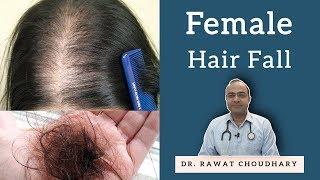 महिलाओं के बाल झड़ना | Female Hair Fall | Female Hair Loss | Yash Homeopathic Center Jodhpur